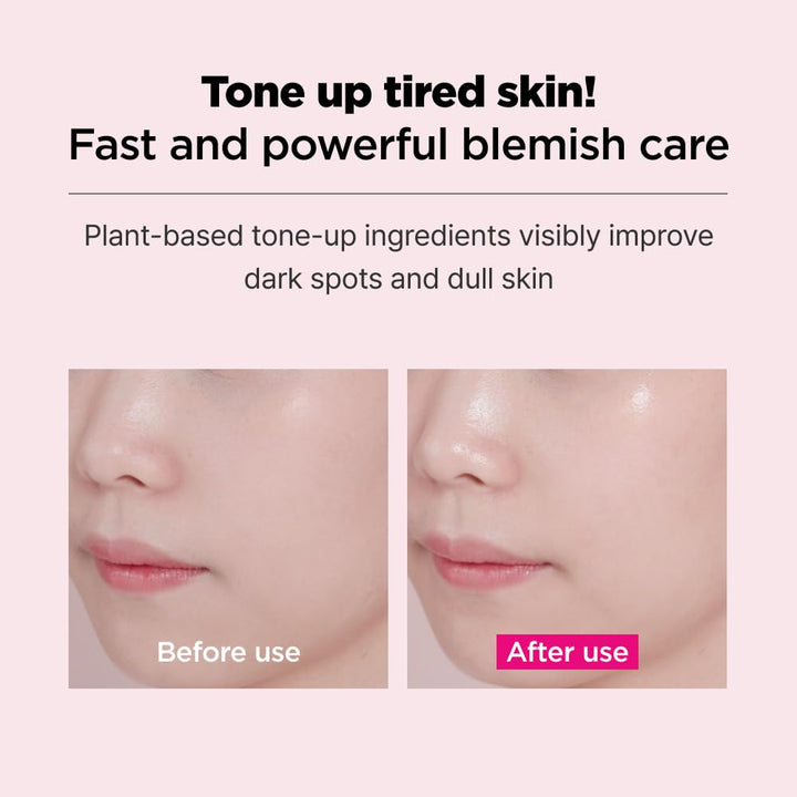 ISOI Blemish Care Mask Pack 10EA