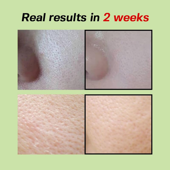 SUNGBOON EDITOR Green Tomato Pore Lifting Ampoule 1.01 Fl. Oz, 30ml