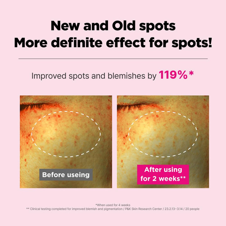 ISOI Blemish Care Up Cream 55ml (1.86 fl.oz)