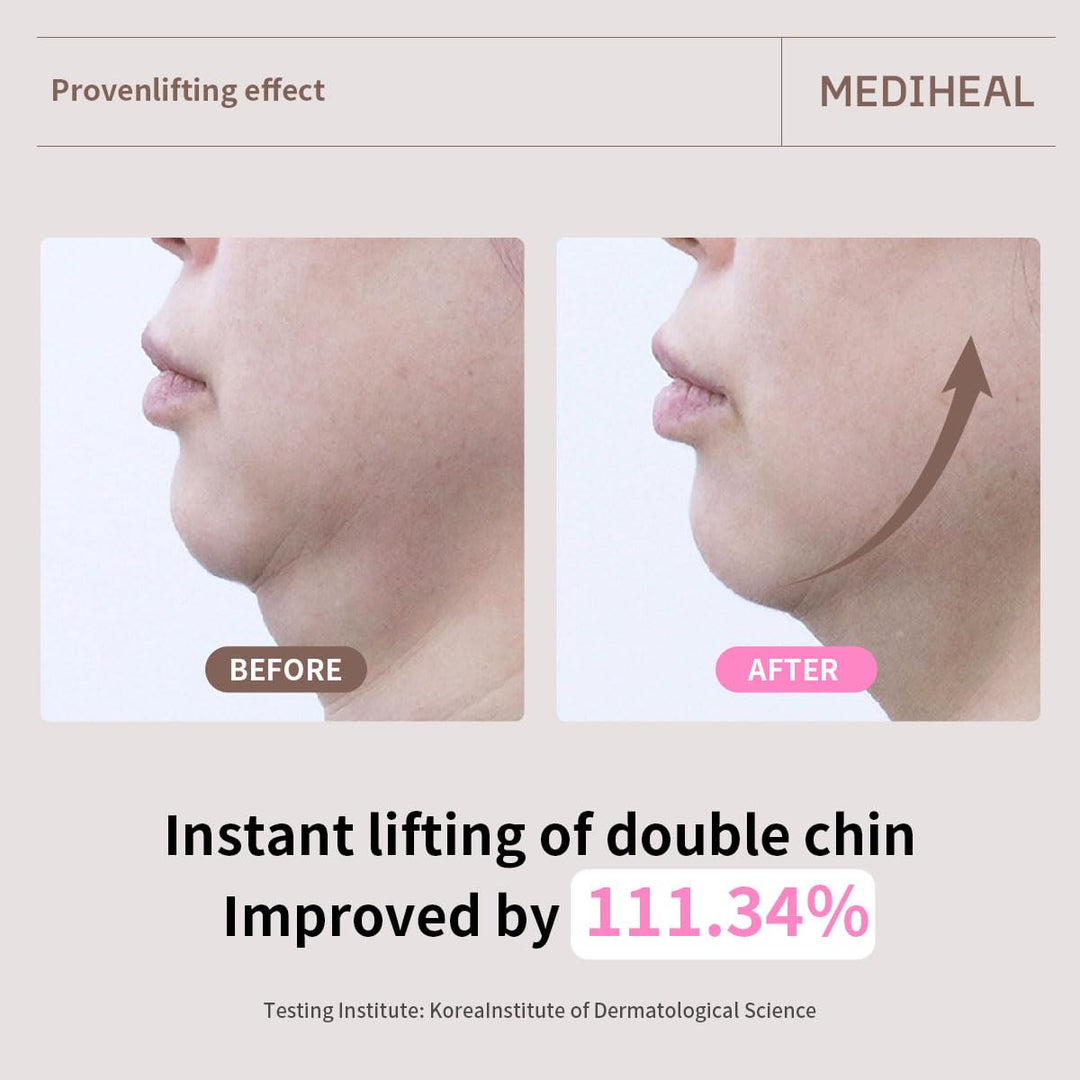 MEDIHEAL Retinol Collagen Ampoule Lifting Mask (4 Counts)