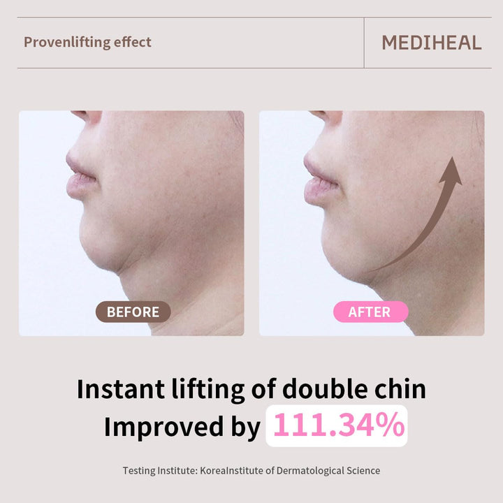 MEDIHEAL Retinol Collagen Ampoule Lifting Mask (4 Counts)