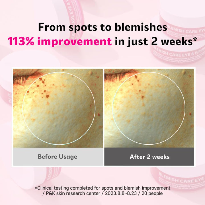 ISOI Blemish Care Eye & Wrinkle Patch 90g (90pcs)(sold out)