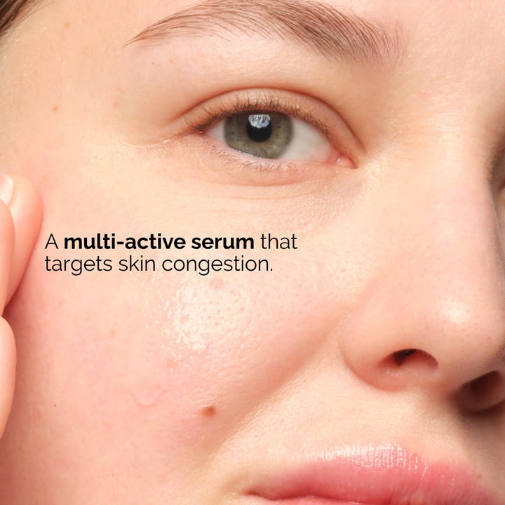 The Ordinary Balancing & Clarifying Serum, Multi-Active Solution for Oil Control and Pore Refinement, 1 Fl Oz