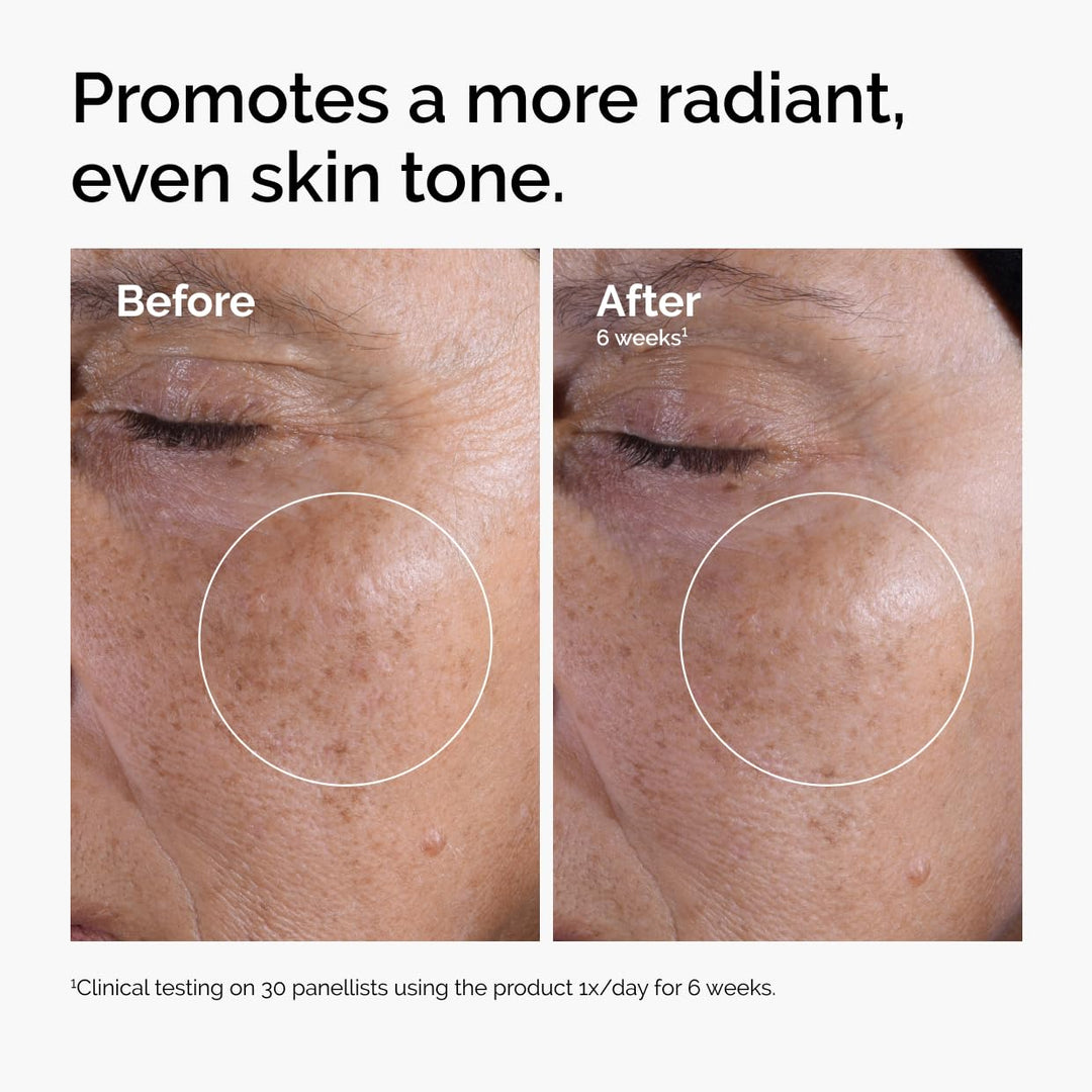 The Ordinary Glycolic Acid 7% Exfoliating Toner 8.1 Fl Oz