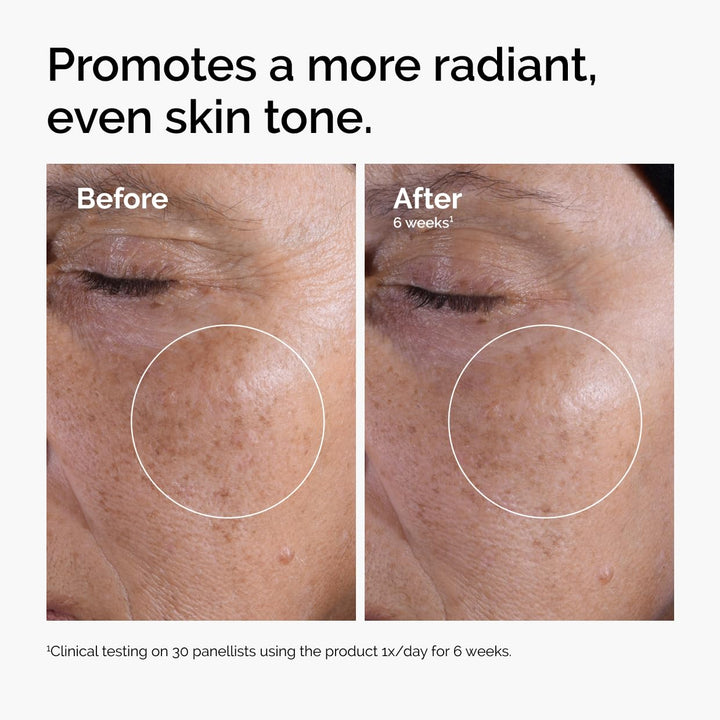 The Ordinary Glycolic Acid 7% Exfoliating Toner 8.1 Fl Oz