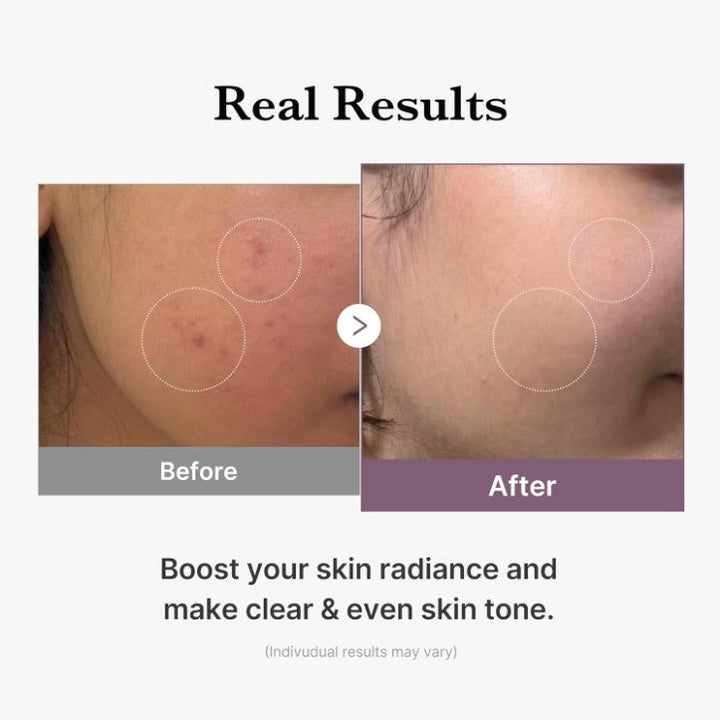 Medicube Age-R Glutathione Glow Milky Toner 140ml
