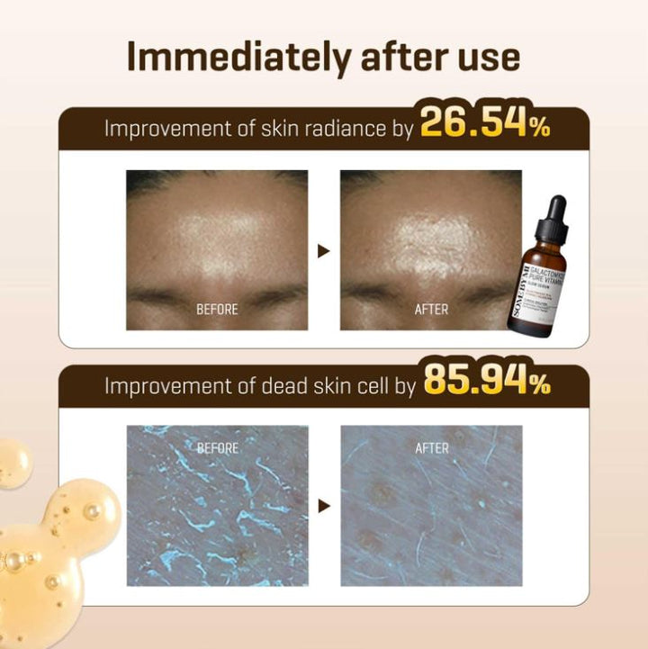 SOME BY MI Galactomyces Pure Vitamin C Glow Serum 30ml / 1.01 oz.