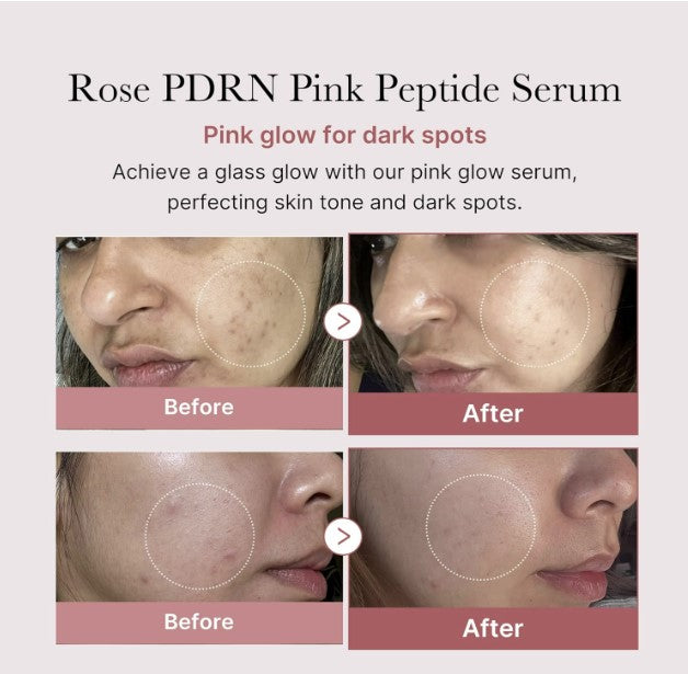 Medicube PDRN Pink Peptide Serum 30ml