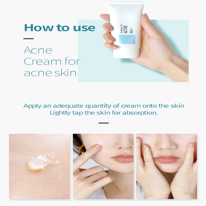 Pyunkang Yul Acne Cream  1.7 Fl. Oz,50ml