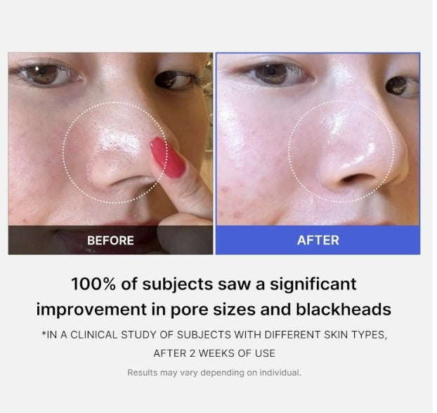 Medicube Zero Pore Pads 2.0 70 Pads